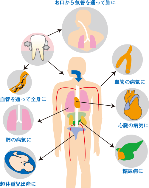 一般診療 | 大阪市北区・梅田アップル歯科