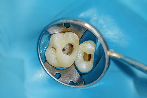 どのくらいの痛みが正常ですか？