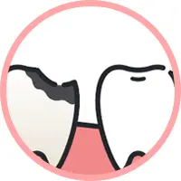 前歯の虫歯イメージ