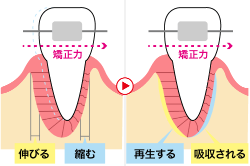 矯正の歯の動き