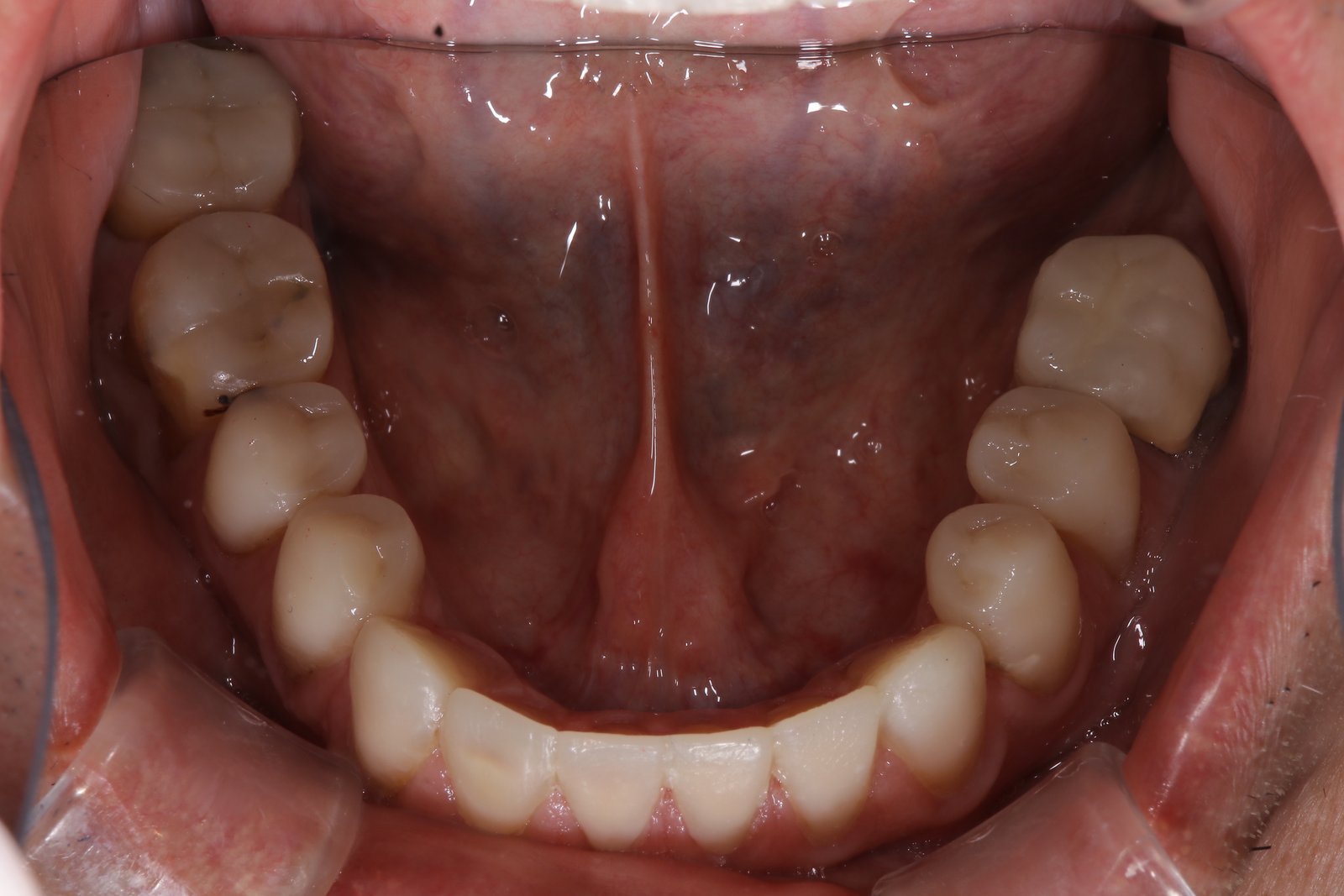 process6